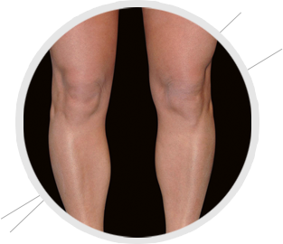 augmentation des mollets